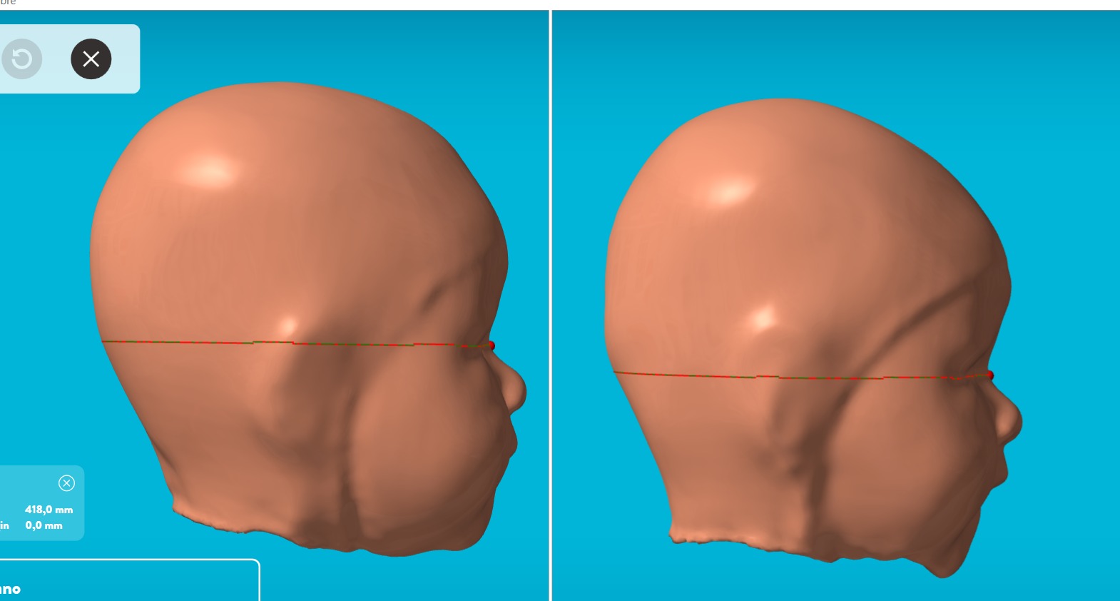 Bebê feliz após tratamento bem-sucedido